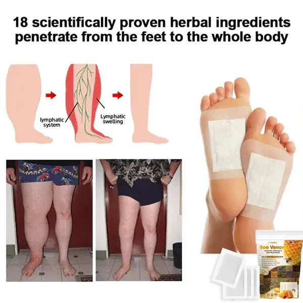 Bee Venom Lymphatic Drainage & Sliming Patches (10 Patches)